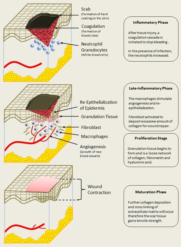 stages of tissue healing